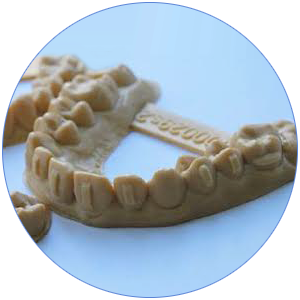 Dental crown models 3D printing